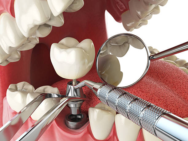 Best Emergency Denture Repair in Carnegie, OK